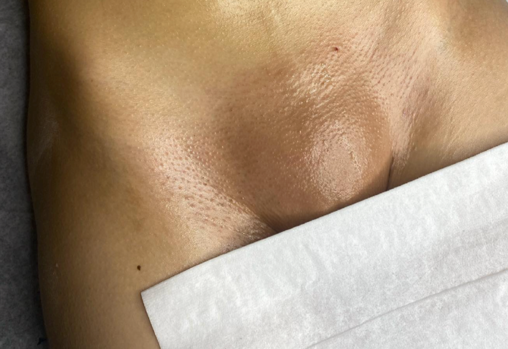 brazilian waxing at sweet brook massage spa
